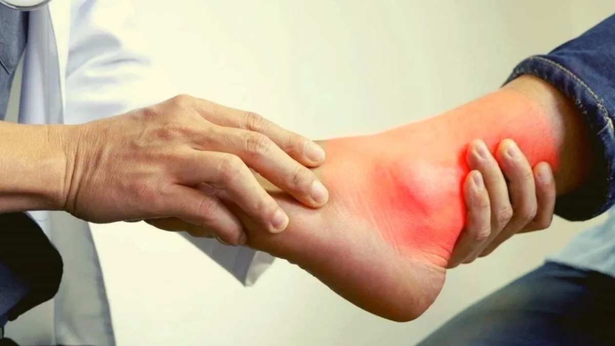 यूरिक एसिड बढ़ने से स्किन में नजर आने लगते हैं ये लक्षण, तो तुरंत करें डॉ से संपर्क 