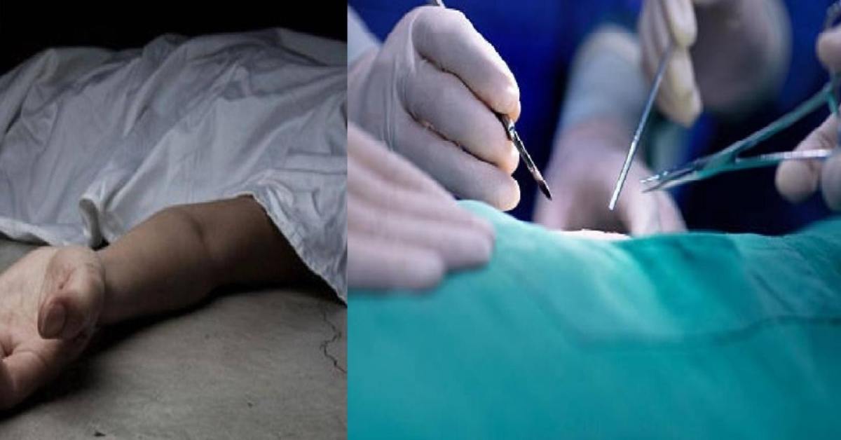 लापरवाही ने छीन ली जिंदगी! ऑपरेशन के दौरान महिला के पेट में छूटा तौलिया, पांच महीने बाद हो गई मौत